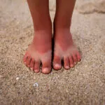 Toenail fungus